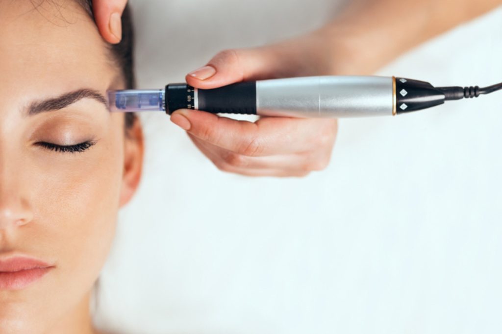 The Advantages of Using a Microneedling Pen at Home